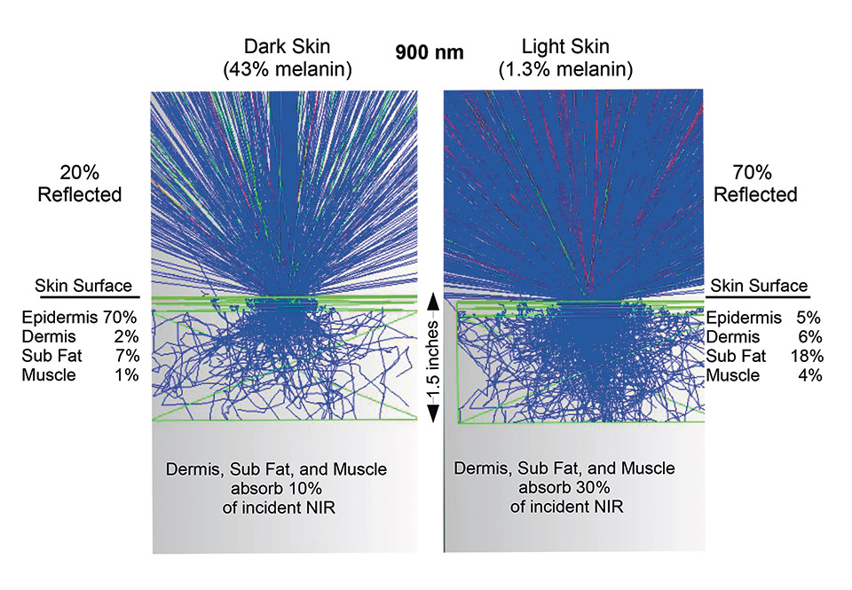 Figure 4: Lambda Research TracePro model of the differences how NIR light is absorbed in the human body. NIR uniquely penetrates over an inch into our body (even our skull) reducing inflammation, enhancing cognitive skills, and stimulating muscle strength