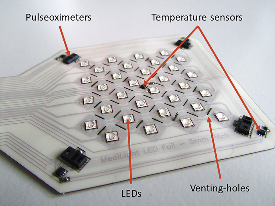 Figure 9: Flex-foil with mounted components